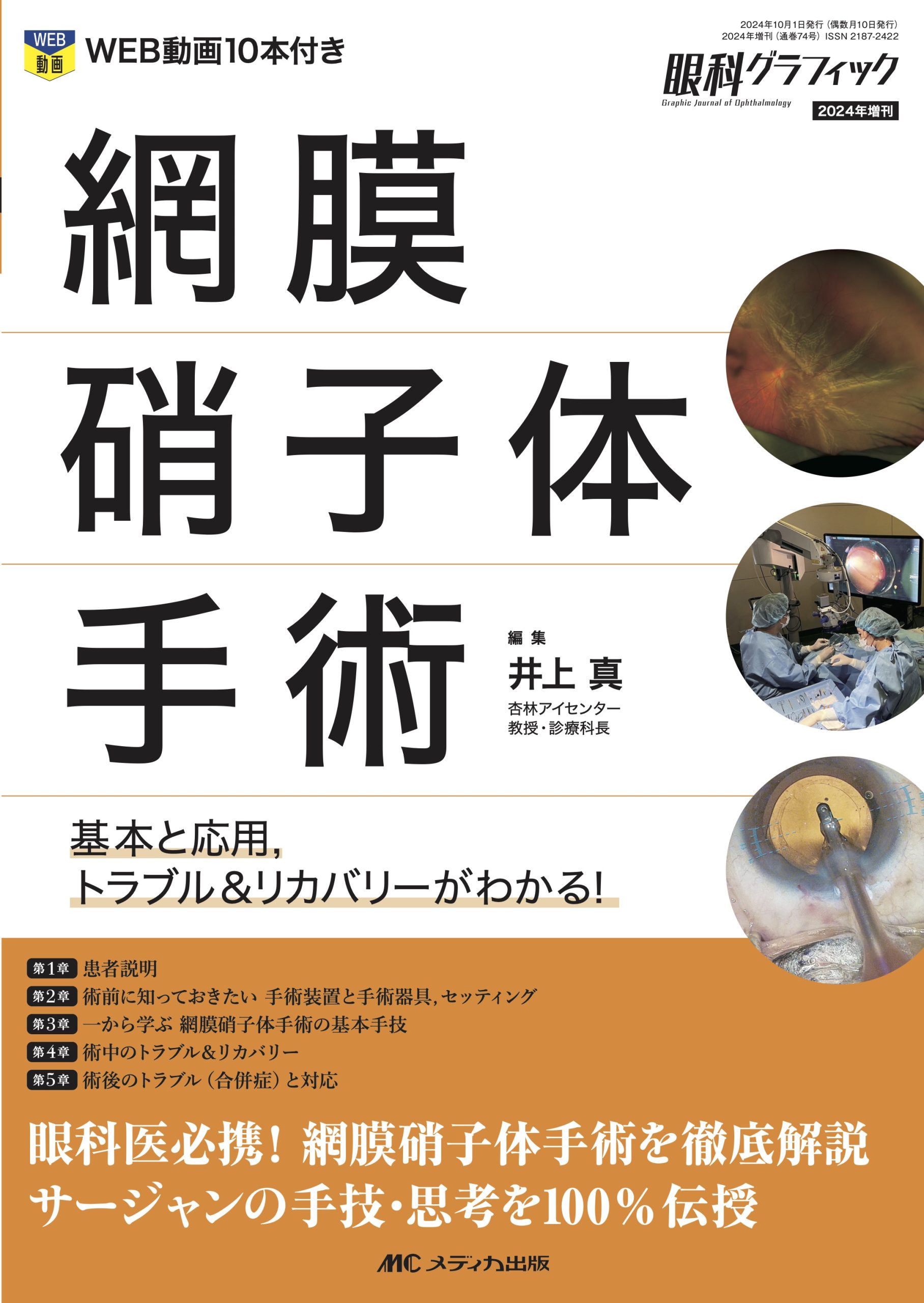 眼科グラフィック2024増刊号の表紙に掲載して頂きました
